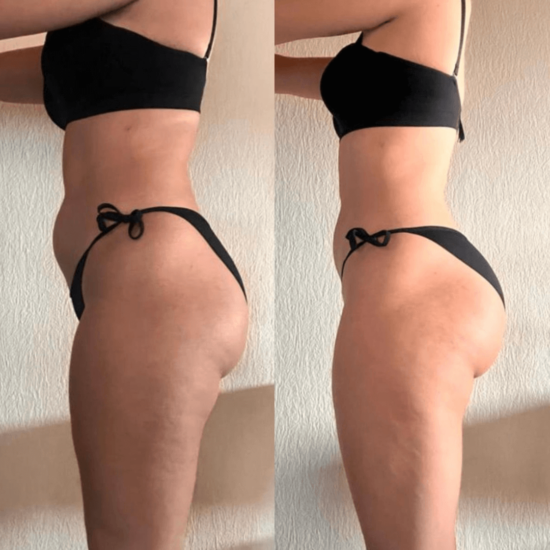 Before and after image of client